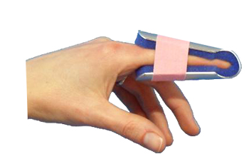 STECCA PER FRATTURA DITA A CAMPANA FARMASPLINT MISURA PICCOLA PREFORMATA IN ALLUMINIO MODELLABILE CON IMBOTTITURA IN SPUGNA POLIURETANICA ANTIALLERGICA RADIOTRASPARENTE 7 CM - Farmacia Castello Srl
